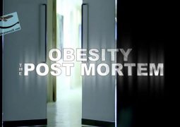 چاقی: کالبدشکافی (۲۰۱۶)